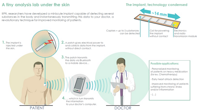 Un implant pour surveiller sa bonne santé sur smartphone