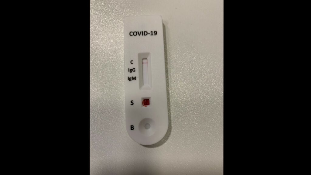 Covid Les Tests Serologiques Rapides En Pharmacie Coutent Cher Et Ne Servent A Rien